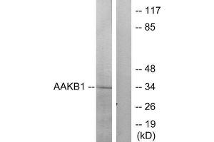 Western Blotting (WB) image for anti-Protein Kinase, AMP-Activated, beta 1 Non-Catalytic Subunit (PRKAB1) (N-Term) antibody (ABIN1850405) (PRKAB1 antibody  (N-Term))