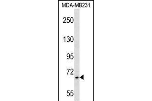 Zinc Finger Protein 44 antibody  (N-Term)