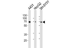 Western blot analysis of lysates from A431, HepG2, SH-SY5Y cell line (from left to right), using EIF2AK2 Antibody (ABIN6243641 and ABIN6577090). (EIF2AK2 antibody  (AA 1-250))