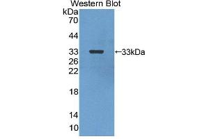 Western blot analysis of the recombinant protein. (CA13 antibody  (AA 1-262))