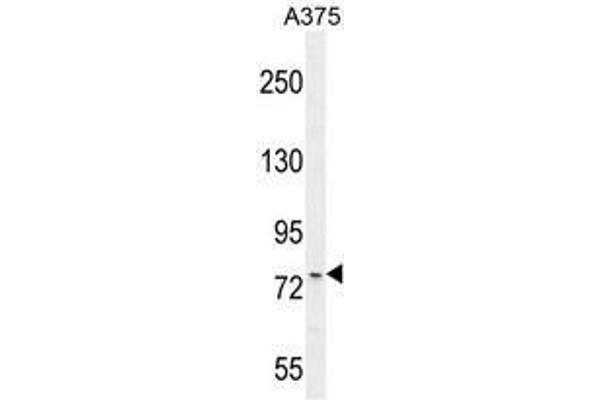 ANKRD44 antibody  (Middle Region)