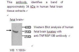 Image no. 1 for anti-Tumor Necrosis Factor Receptor Superfamily, Member 13B (TNFRSF13B) antibody (ABIN790808) (TACI antibody)