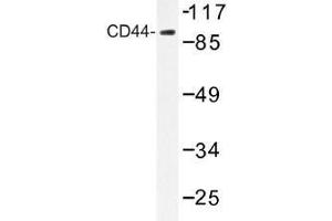 Image no. 1 for anti-CD44 (CD44) antibody (ABIN317946) (CD44 antibody)