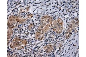 Immunohistochemistry (IHC) image for anti-Lipase, Endothelial (LIPG) antibody (ABIN1499170) (LIPG antibody)