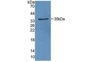 Western blot analysis of recombinant Rat VEGFR2. (VEGFR2/CD309 antibody  (AA 46-320))