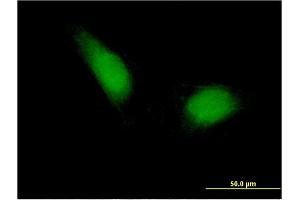 Immunofluorescence of monoclonal antibody to ETS1 on HeLa cell. (ETS1 antibody  (AA 173-272))