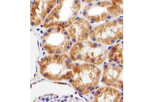 Paraformaldehyde-fixed, paraffin embedded SAMPLE tissue, Antigen retrieval by boiling in sodium citrate buffer (pH6. (BCL10 antibody)