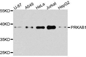 Western blot analysis of extracts of various cell lines, using PRKAB1 antibody. (PRKAB1 antibody)