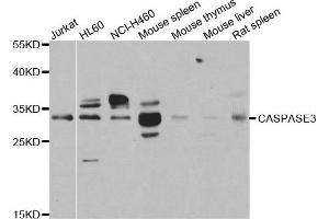 Western blot analysis of extracts of various cell lines using CASP3 antibody. (Caspase 3 antibody)