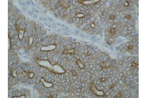 Immunohistochemistry (Paraffin-embedded Sections) (IHC (p)) image for anti-pan Keratin (panKRT) antibody (ABIN94275)