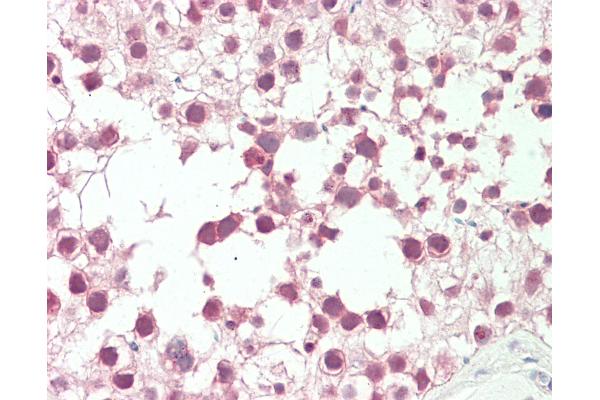 RANBP2 antibody  (AA 1050-1100)