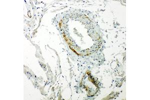 Anti-Caveolin-2 antibody, IHC(P) IHC(P): Rat Cardiac Muscle Tissue (Caveolin 2 antibody  (N-Term))