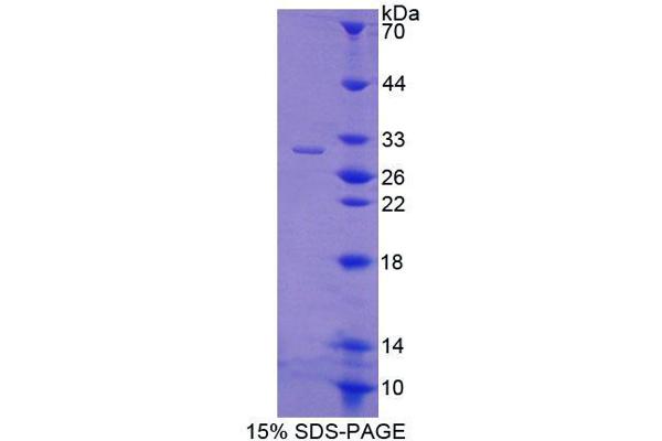 ABCB8 Protein (AA 468-714) (T7 tag,His tag)