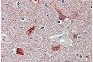 Immunohistochemistry (IHC) image for anti-Calcium/calmodulin-Dependent Protein Kinase II alpha (CAMK2A) (Internal Region) antibody (ABIN2464145) (CAMK2A antibody  (Internal Region))