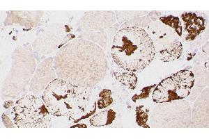 Immunohistochemistry (IHC) image for anti-Myotilin (MYOT) (C-Term) antibody (ABIN7538828) (Myotilin antibody  (C-Term))