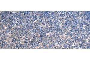 Immunohistochemistry of paraffin-embedded Human tonsil tissue using HSPA5 Polyclonal Antibody at dilution of 1:35(x200) (GRP78 antibody)