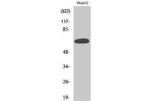 Western Blotting (WB) image for anti-Estrogen Receptor 1 (ESR1) (Ser362) antibody (ABIN3175023) (Estrogen Receptor alpha antibody  (Ser362))