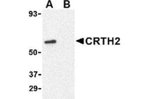 Western blot analysis of CRTH2 in Jurkat cell lysate with CRTH2 antibody at 1 μg/ml in (A) the absence and (B) presence of blocking peptide. (Prostaglandin D2 Receptor 2 (PTGDR2) (N-Term) antibody)