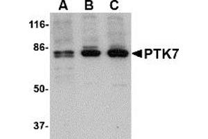 Western Blotting (WB) image for anti-PTK7 Protein tyrosine Kinase 7 (PTK7) (N-Term) antibody (ABIN1031528) (PTK7 antibody  (N-Term))