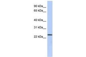 Image no. 1 for anti-UL16 Binding Protein 1 (ULBP1) (N-Term) antibody (ABIN6743537) (ULBP1 antibody  (N-Term))