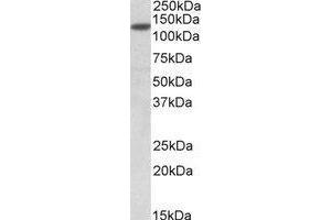 AP23761PU-N SIRT1 antibody staining of Jurkat lysate at 0. (SIRT1 antibody  (Internal Region))