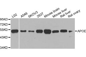 Western blot analysis of extracts of various cell lines, using APOE antibody. (APOE antibody)