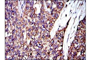 Immunohistochemistry (IHC) image for anti-V-Crk Sarcoma Virus CT10 Oncogene Homolog (Avian) (CRK) antibody (ABIN969062)