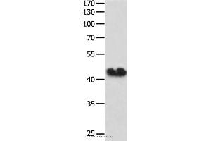 Western blot analysis of Hela cell , using GJA1 Polyclonal Antibody at dilution of 1:250 (Connexin 43/GJA1 antibody)