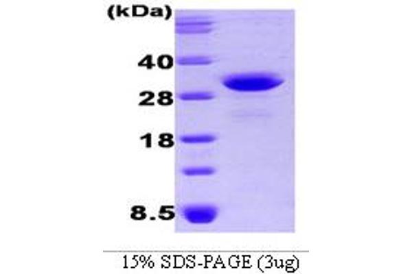 OSTF1 Protein (AA 1-217) (His tag)