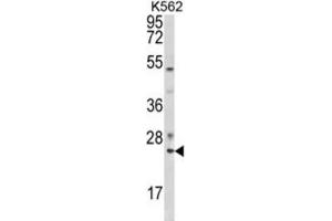 Western Blotting (WB) image for anti-RAB7A, Member RAS Oncogene Family (RAB7A) antibody (ABIN3003858) (RAB7A antibody)