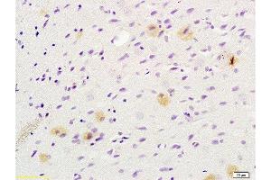 Formalin-fixed and paraffin embedded rat brain tissue labeled with Anti-Tsg101 Polyclonal Antibody , Unconjugated at 1:200 followed by conjugation to the secondary antibody, (SP-0023), and DAB staining (TSG101 antibody  (AA 4-120))