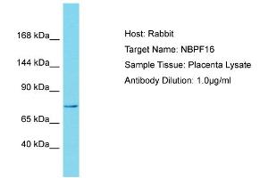 Host: Rabbit Target Name: NBPF15 Sample Tissue: Human Placenta Antibody Dilution: 1ug/ml (NBPF15 antibody  (N-Term))