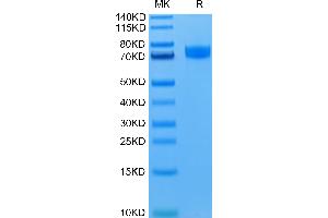 SDS-PAGE (SDS) image for Sialic Acid Binding Ig-Like Lectin 10 (SIGLEC10) (AA 17-546) protein (His tag) (ABIN7275592)