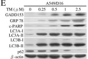 Western Blotting (WB) image for anti-Sequestosome 1 (SQSTM1) antibody (ABIN2854836)