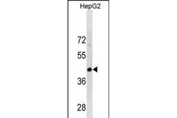 LRRC19 antibody  (C-Term)