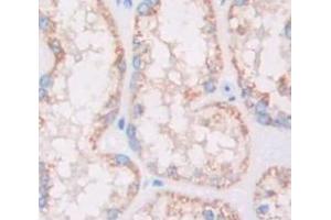 Used in DAB staining on fromalin fixed paraffin- embedded Kidney tissue (HSD17B12 antibody  (AA 1-312))