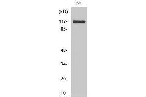 Western Blotting (WB) image for anti-Calcium Channel, Voltage-Dependent, alpha 2/delta Subunit 4 (CACNA2D4) (Internal Region) antibody (ABIN3183610) (CACNA2D4 antibody  (Internal Region))