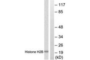 Western blot analysis of extracts from Raw264. (Histone H2B antibody  (AA 11-60))