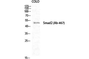 Western Blot analysis of COLO cells using Smad2 Polyclonal Antibody diluted at 1:1000. (SMAD2 antibody)