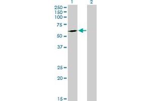 Western Blot analysis of FPGT expression in transfected 293T cell line by FPGT MaxPab polyclonal antibody. (FPGT antibody  (AA 1-594))