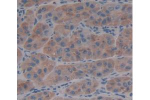 IHC-P analysis of liver tissue, with DAB staining. (ADAMTS13 antibody  (AA 896-1131))