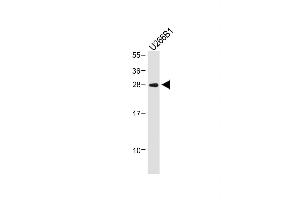 Anti-IGLL5 Antibody (C-term) at 1:1000 dilution + U266B1 whole cell lysate Lysates/proteins at 20 μg per lane. (IGLL5 antibody  (C-Term))