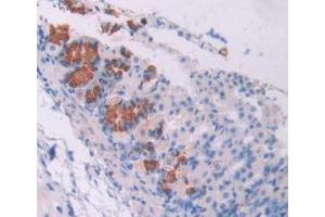 IHC-P analysis of Mouse Stomach Tissue, with DAB staining. (Oncostatin M antibody  (AA 116-205))