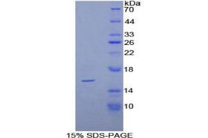 SDS-PAGE analysis of Rat Caspase 3 Protein. (Caspase 3 Protein (CASP3))