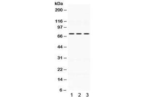 Western blot testing of human 1) HeLa, 2) MCF7 and 3) SW620 lysate wtih KEAP1 antibody. (KEAP1 antibody  (AA 25-205))