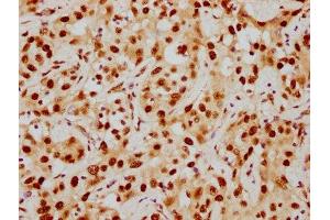 Immunohistochemistry (IHC) image for anti-Histone Deacetylase 9 (HDAC9) antibody (ABIN7127541)