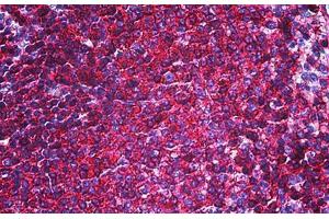 Human Spleen: Formalin-Fixed, Paraffin-Embedded (FFPE) (CD44 antibody)