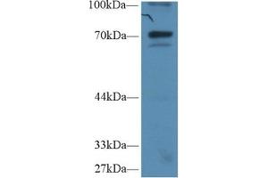 Detection of IkBz in Human Hela cell lysate using Polyclonal Antibody to Inhibitory Subunit Of NF Kappa B Zeta (IkBz) (Inhibitory Subunit of NF-KappaB zeta (AA 422-651) antibody)