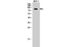 Western Blotting (WB) image for anti-Protein Kinase C (pan) (PKC pan) (Lys246) antibody (ABIN3180264) (PKC antibody  (Lys246))