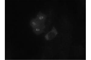 Image no. 1 for anti-Budding Uninhibited By Benzimidazoles 1 Homolog (Yeast) (BUB1) antibody (ABIN341032) (BUB1 antibody)